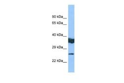 LYPLAL1 Rabbit anti-Human, Polyclonal, Novus Biologicals 0.1 mL | Buy Online | Novus Biologicals | Fisher Scientific